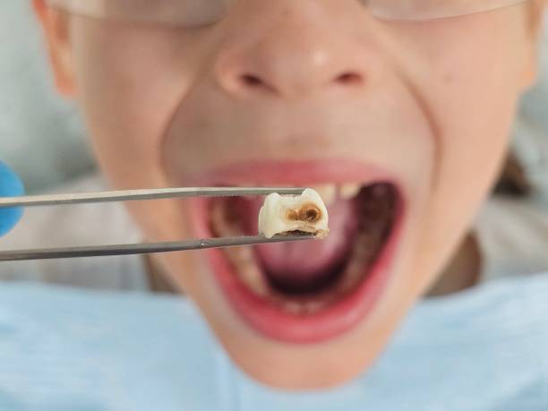 Best Emergency Gum Treatment in Forney, TX