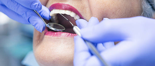 Best Emergency Root Canal Treatment in Forney, TX